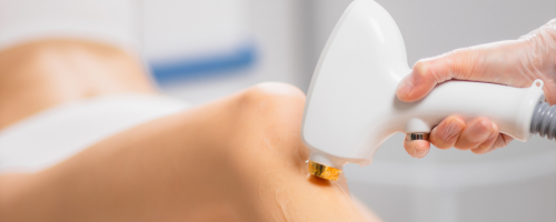 Tratamiento Depilación Triláser