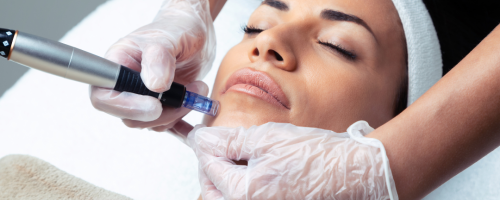 Dermapen: Coctel de Vitaminas