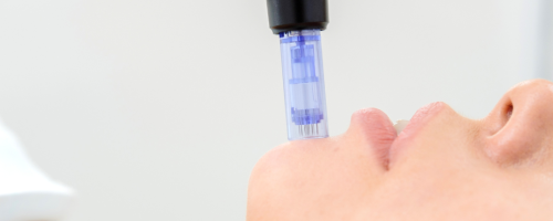 Dermapen: Glow Lift Cóctel Anti-Age