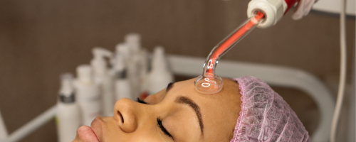 radiofrecuencia facial